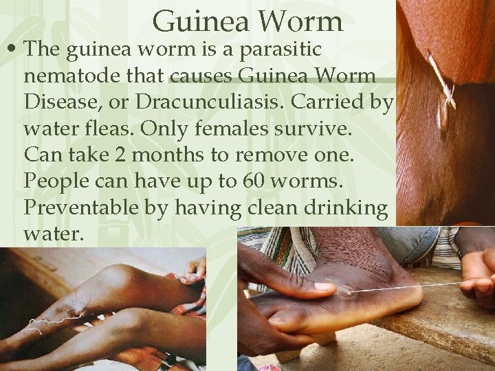 Guinea Worm • The guinea worm is a parasitic nematode that causes Guinea Worm