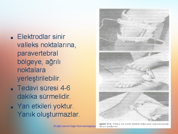 ■ ■ ■ Elektrodlar sinir valleks noktalarına, paravertebral bölgeye, ağrılı noktalara yerleştirilebilir. Tedavi süresi