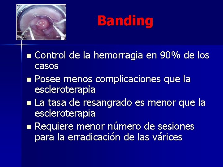 Banding Control de la hemorragia en 90% de los casos n Posee menos complicaciones