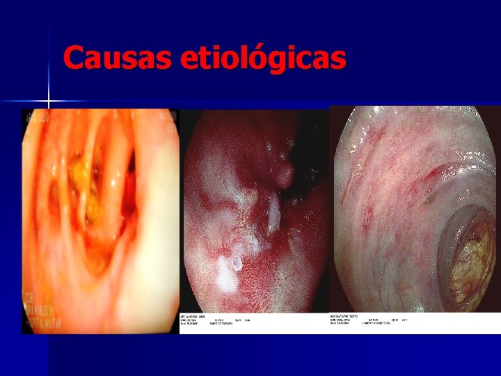 Causas etiológicas 