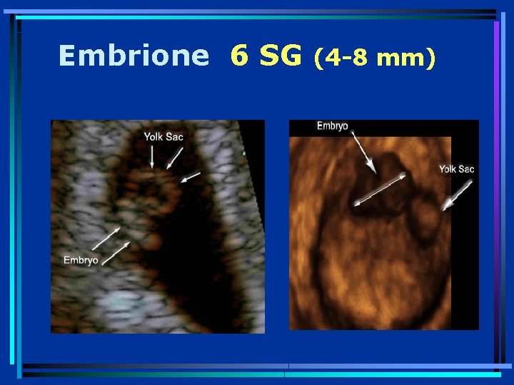 Embrione 6 SG (4 -8 mm) 