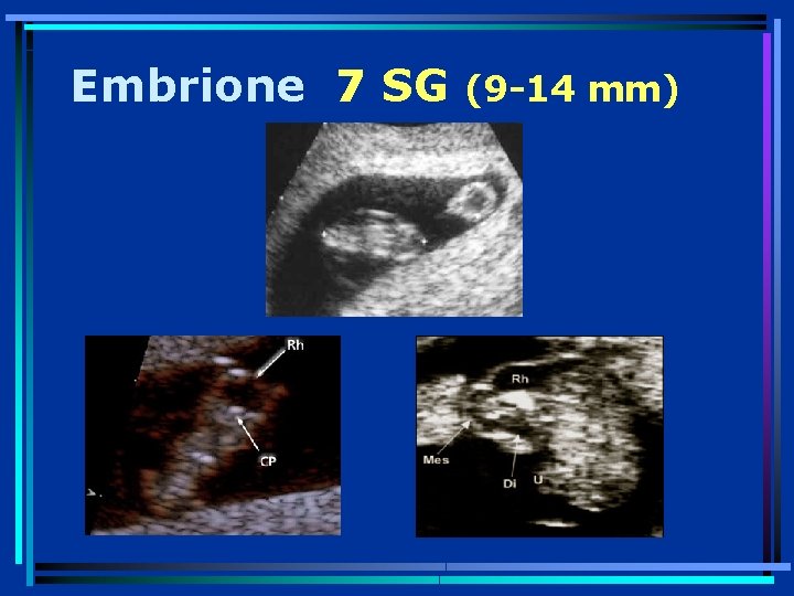 Embrione 7 SG (9 -14 mm) 