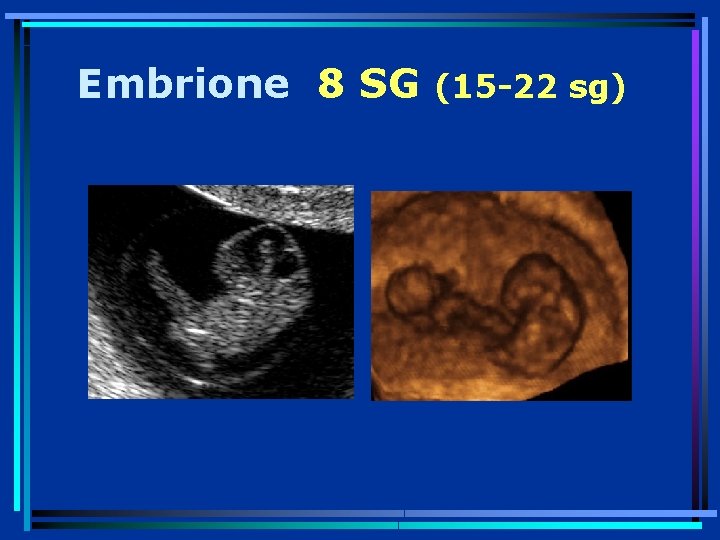 Embrione 8 SG (15 -22 sg) 