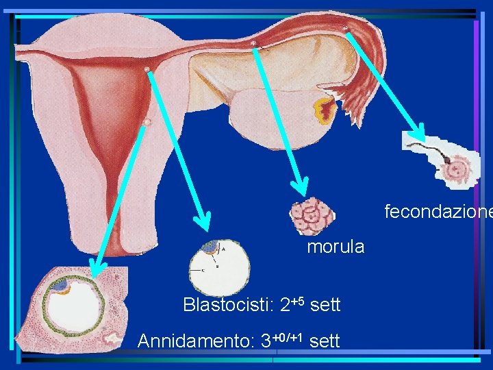 fecondazione morula Blastocisti: 2+5 sett Annidamento: 3+0/+1 sett 