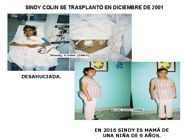SINDY COLIN SE TRASPLANTÓ EN DICIEMBRE DE 2001 DESAHUCIADA. EN 2016 SINDY ES MAMÁ