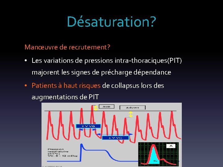 Désaturation? Manœuvre de recrutement? • Les variations de pressions intra-thoraciques(PIT) majorent les signes de