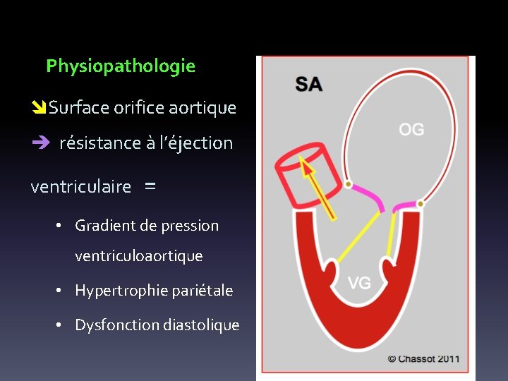 Physiopathologie Surface orifice aortique résistance à l’éjection ventriculaire = • Gradient de pression ventriculoaortique