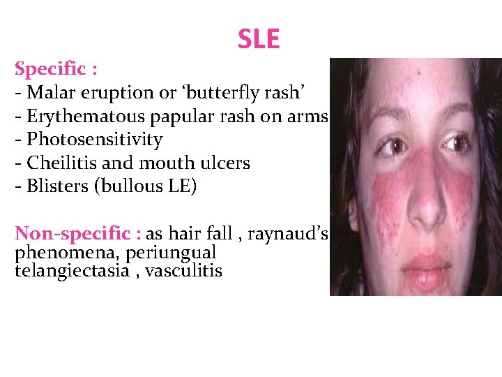 SLE Specific : - Malar eruption or ‘butterfly rash’ - Erythematous papular rash on SLE Specific : - Malar eruption or ‘butterfly rash’ - Erythematous papular rash on