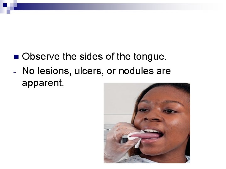 n - Observe the sides of the tongue. No lesions, ulcers, or nodules are