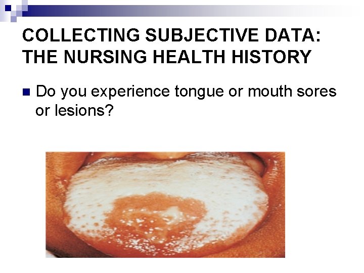 COLLECTING SUBJECTIVE DATA: THE NURSING HEALTH HISTORY n Do you experience tongue or mouth