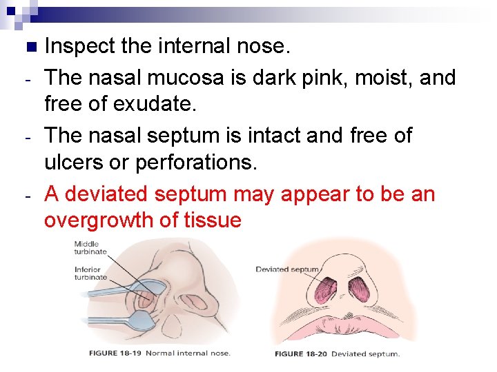 n - Inspect the internal nose. The nasal mucosa is dark pink, moist, and