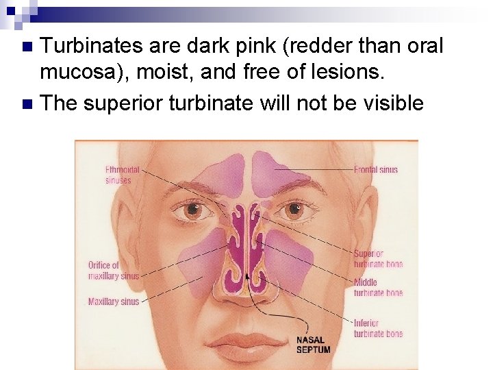 Turbinates are dark pink (redder than oral mucosa), moist, and free of lesions. n