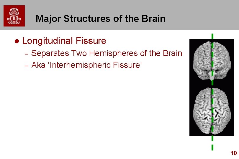Major Structures of the Brain l Longitudinal Fissure – – Separates Two Hemispheres of Major Structures of the Brain l Longitudinal Fissure – – Separates Two Hemispheres of