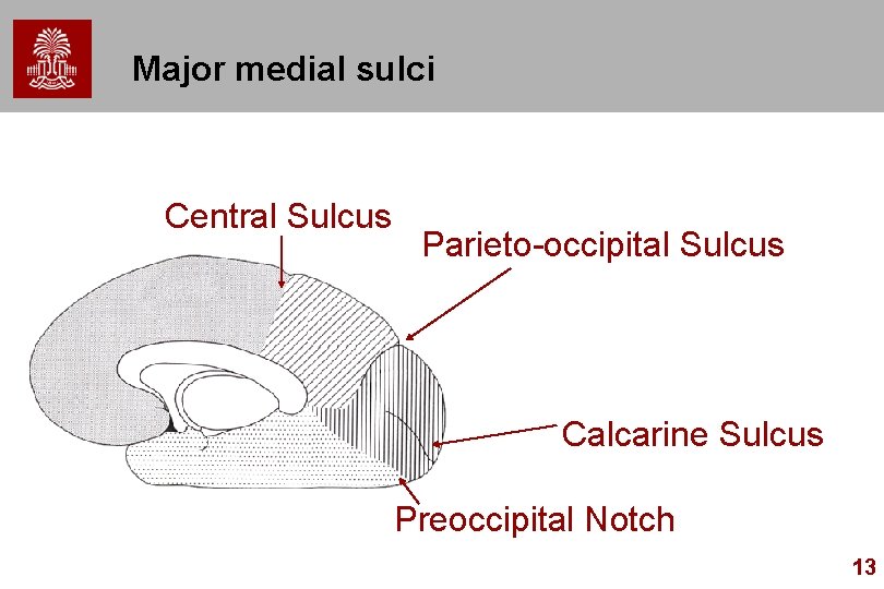 Major medial sulci Central Sulcus Parieto-occipital Sulcus Calcarine Sulcus Preoccipital Notch 13 Major medial sulci Central Sulcus Parieto-occipital Sulcus Calcarine Sulcus Preoccipital Notch 13
