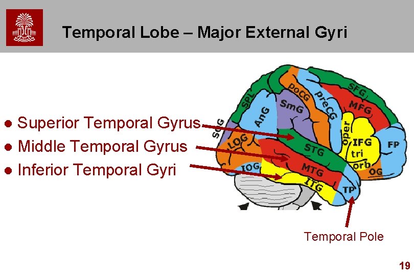 Temporal Lobe – Major External Gyri Superior Temporal Gyrus l Middle Temporal Gyrus l Temporal Lobe – Major External Gyri Superior Temporal Gyrus l Middle Temporal Gyrus l