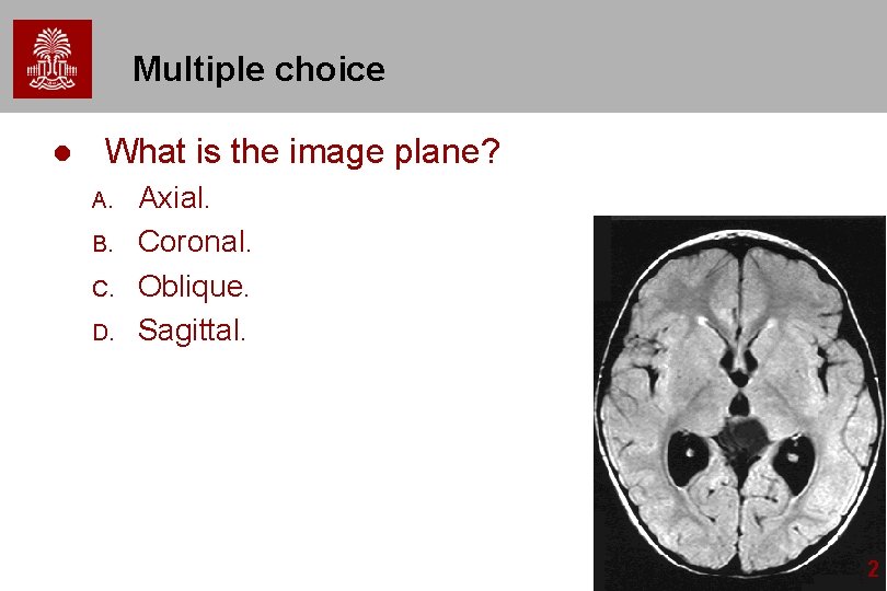 Multiple choice l What is the image plane? A. B. C. D. Axial. Coronal. Multiple choice l What is the image plane? A. B. C. D. Axial. Coronal.