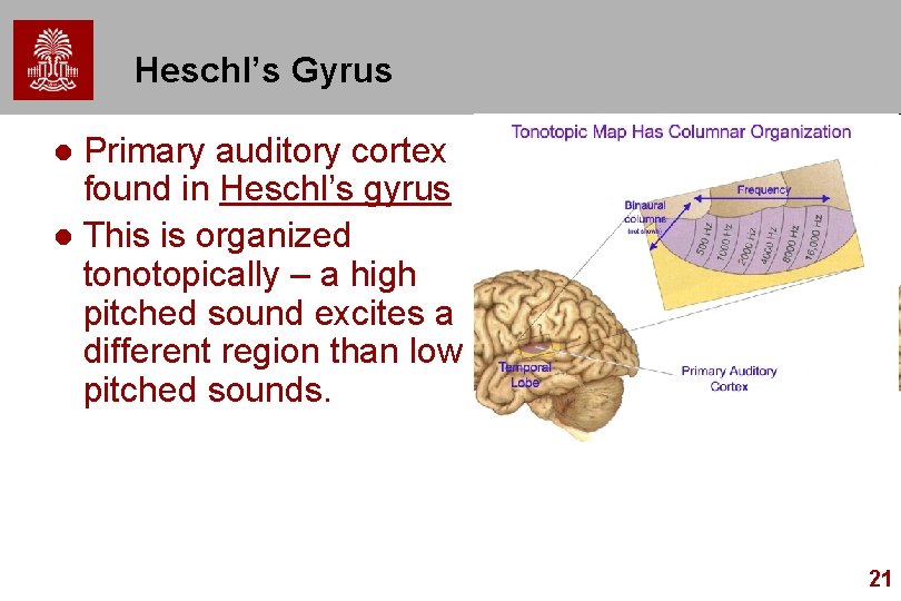 Heschl’s Gyrus Primary auditory cortex found in Heschl’s gyrus l This is organized tonotopically Heschl’s Gyrus Primary auditory cortex found in Heschl’s gyrus l This is organized tonotopically
