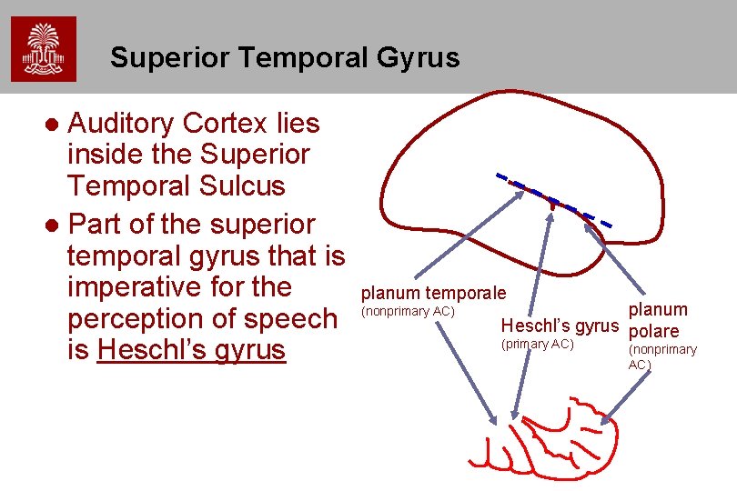 Superior Temporal Gyrus Auditory Cortex lies inside the Superior Temporal Sulcus l Part of Superior Temporal Gyrus Auditory Cortex lies inside the Superior Temporal Sulcus l Part of