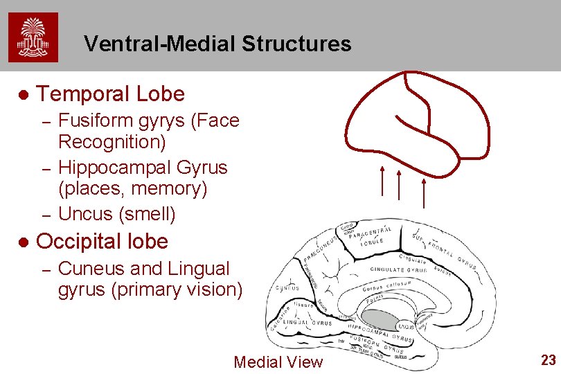Ventral-Medial Structures l Temporal Lobe – – – l Fusiform gyrys (Face Recognition) Hippocampal Ventral-Medial Structures l Temporal Lobe – – – l Fusiform gyrys (Face Recognition) Hippocampal