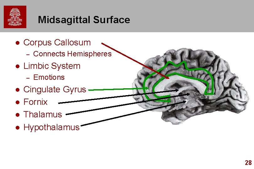 Midsagittal Surface l Corpus Callosum – l Limbic System – l l Connects Hemispheres Midsagittal Surface l Corpus Callosum – l Limbic System – l l Connects Hemispheres