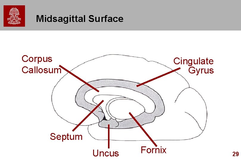Midsagittal Surface Corpus Callosum Cingulate Gyrus Septum Uncus Fornix 29 Midsagittal Surface Corpus Callosum Cingulate Gyrus Septum Uncus Fornix 29