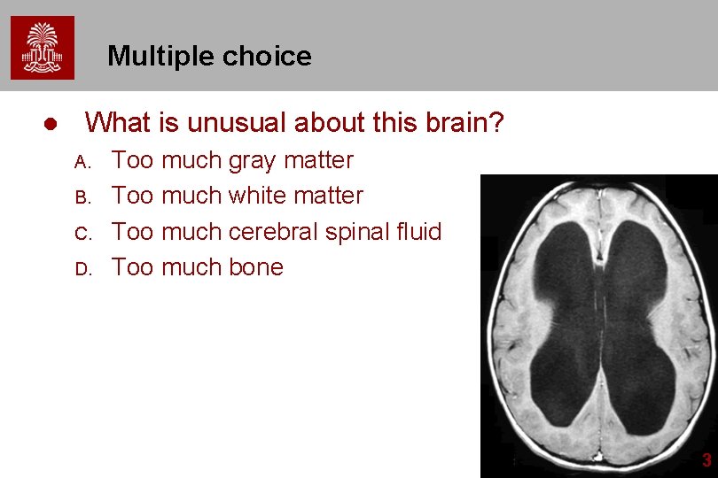 Multiple choice l What is unusual about this brain? A. B. C. D. Too Multiple choice l What is unusual about this brain? A. B. C. D. Too