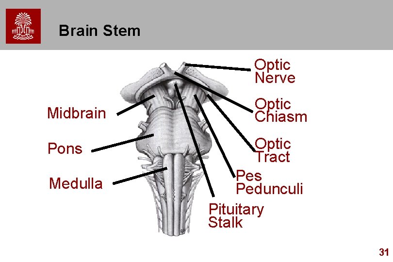Brain Stem Optic Nerve Midbrain Pons Medulla Optic Chiasm Optic Tract Pes Pedunculi Pituitary Brain Stem Optic Nerve Midbrain Pons Medulla Optic Chiasm Optic Tract Pes Pedunculi Pituitary