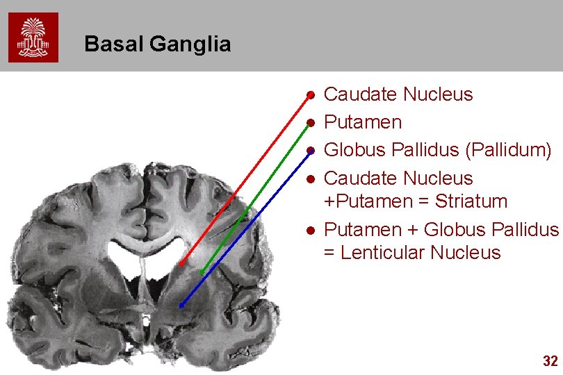 Basal Ganglia l l l Caudate Nucleus Putamen Globus Pallidus (Pallidum) Caudate Nucleus +Putamen Basal Ganglia l l l Caudate Nucleus Putamen Globus Pallidus (Pallidum) Caudate Nucleus +Putamen