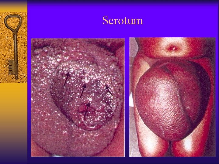 Scrotum 