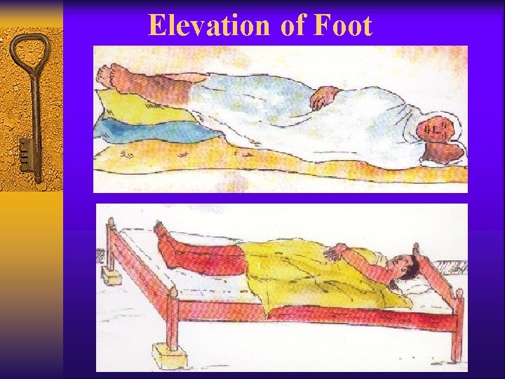 Elevation of Foot 