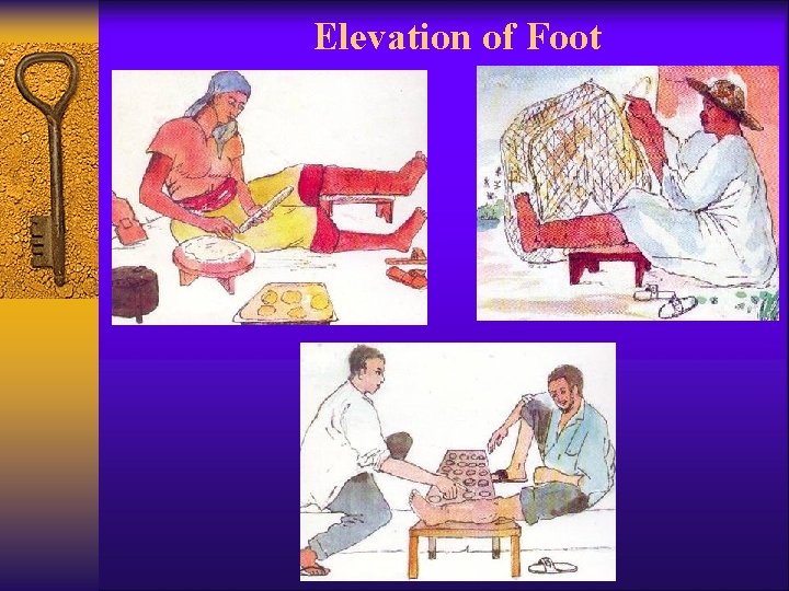 Elevation of Foot 