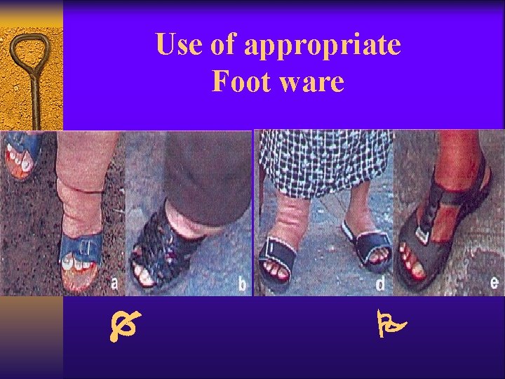 Use of appropriate Foot ware 