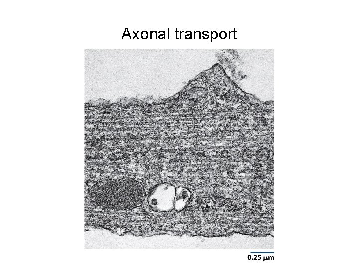 Axonal transport 