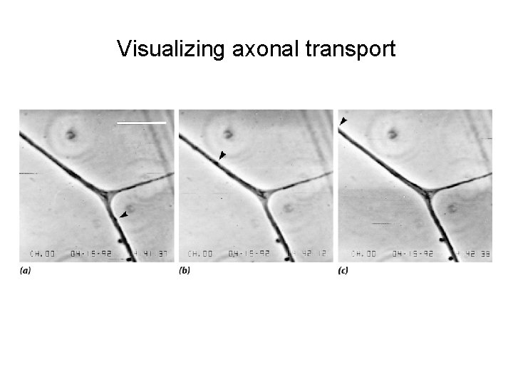 Visualizing axonal transport 