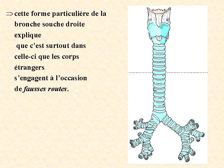  cette forme particulière de la bronche souche droite explique c’est surtout dans celle-ci