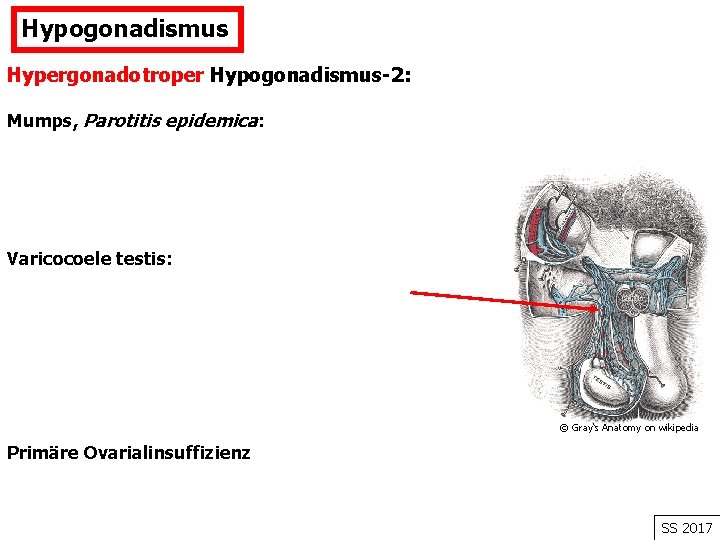Hypogonadismus Hypergonadotroper Hypogonadismus-2: Mumps, Parotitis epidemica: Varicocoele testis: © Gray‘s Anatomy on wikipedia Primäre