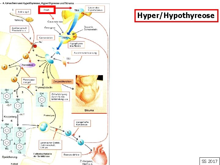 Hyper/Hypothyreose SS 2017 