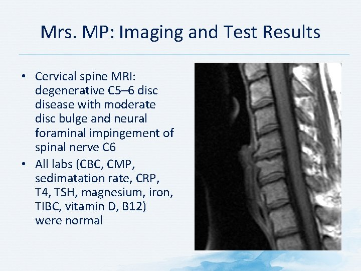 Mrs. MP: Imaging and Test Results • Cervical spine MRI: degenerative C 5– 6