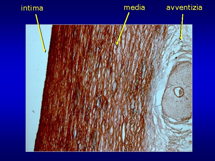 intima media avventizia intima media avventizia