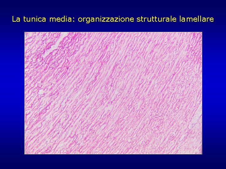 La tunica media: organizzazione strutturale lamellare La tunica media: organizzazione strutturale lamellare