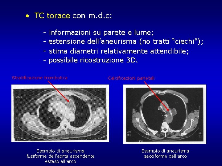• TC torace con m. d. c: - informazioni su parete e lume; • TC torace con m. d. c: - informazioni su parete e lume;