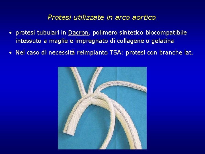 Protesi utilizzate in arco aortico • protesi tubulari in Dacron, polimero sintetico biocompatibile intessuto Protesi utilizzate in arco aortico • protesi tubulari in Dacron, polimero sintetico biocompatibile intessuto
