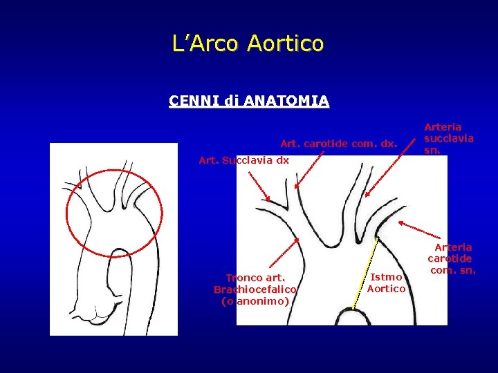 L’Arco Aortico CENNI di ANATOMIA Art. carotide com. dx. Art. Succlavia dx Tronco art. L’Arco Aortico CENNI di ANATOMIA Art. carotide com. dx. Art. Succlavia dx Tronco art.