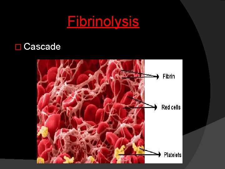 Fibrinolysis � Cascade 