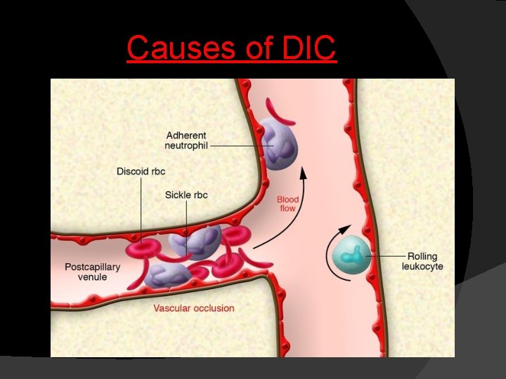 Causes of DIC 
