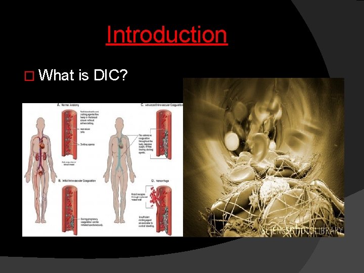 Introduction � What is DIC? 