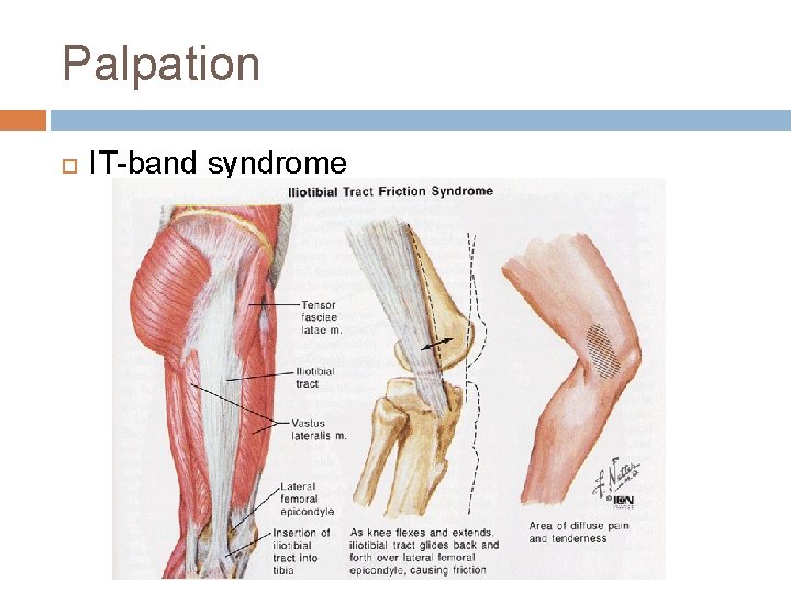 Palpation IT-band syndrome 