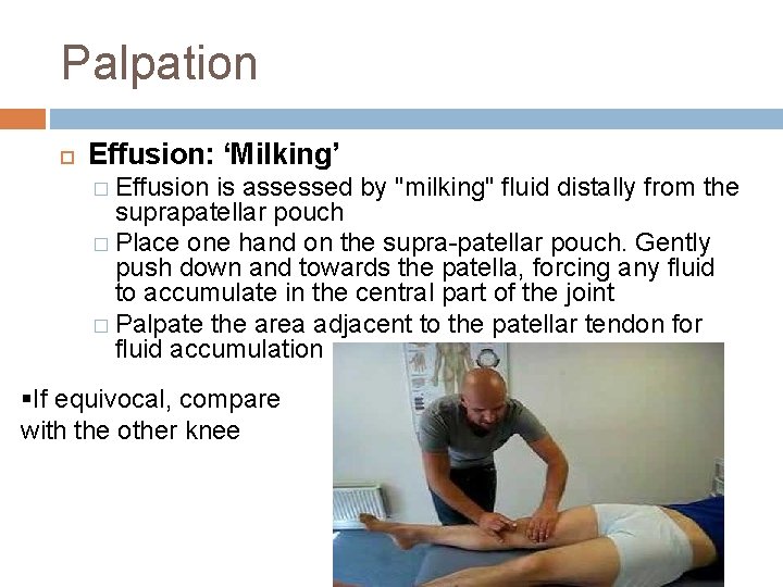 Palpation Effusion: ‘Milking’ � Effusion is assessed by "milking" fluid distally from the suprapatellar