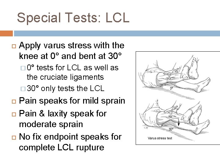 Special Tests: LCL Apply varus stress with the knee at 0° and bent at
