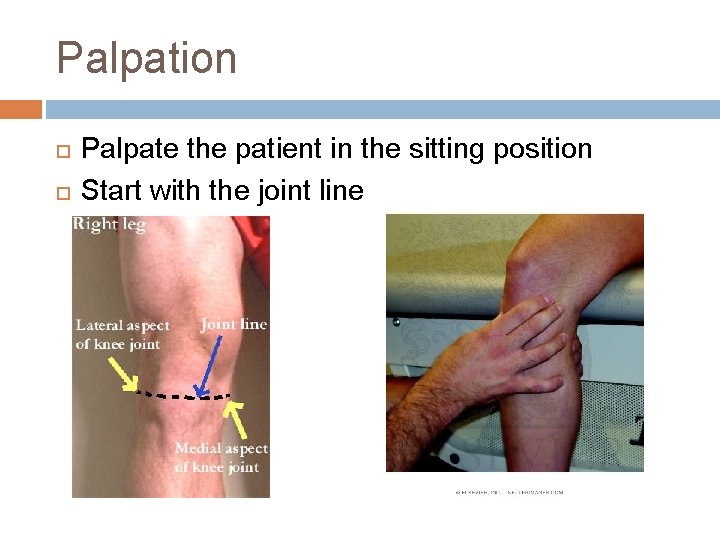 Palpation Palpate the patient in the sitting position Start with the joint line 